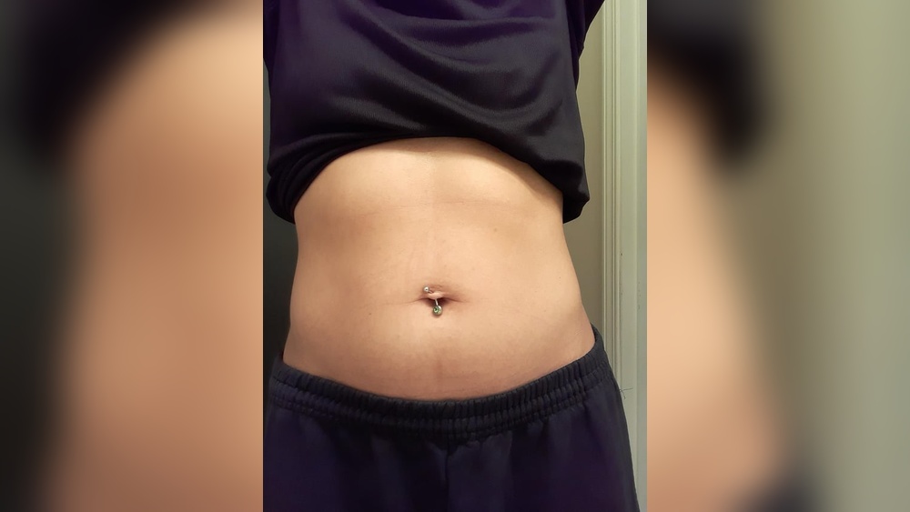 How To Fix A Stretched Belly Button Piercing