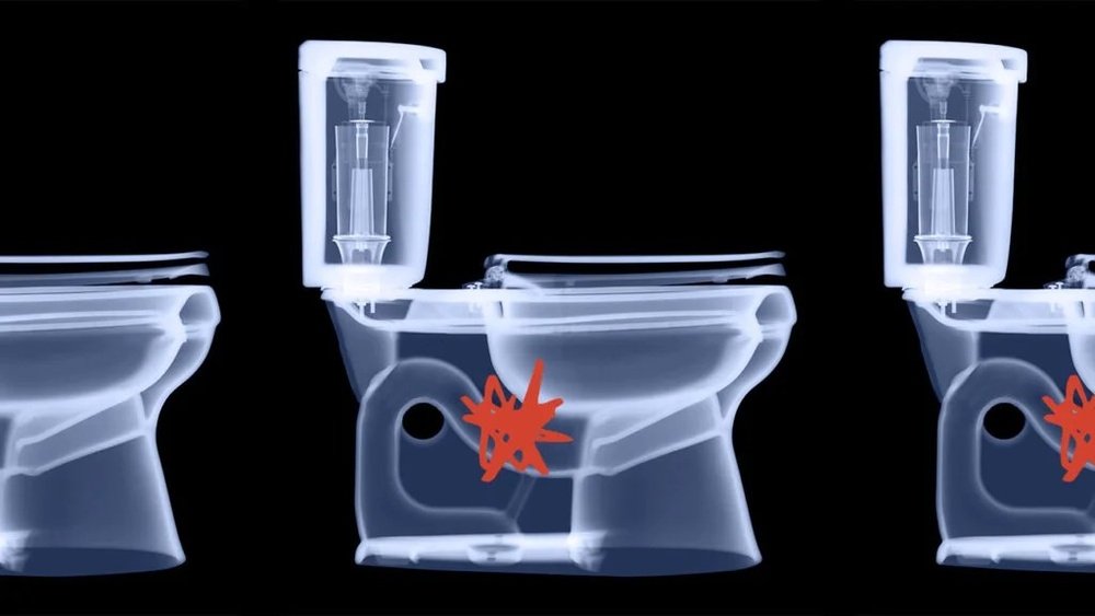 Toilet Clogs Every Time I Poop